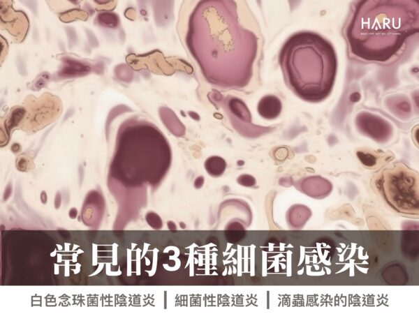 私密處常見的3種細菌感染