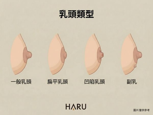 四種常見乳頭類型圖解：一般乳頭、扁平乳頭、凹陷乳頭、副乳示意圖